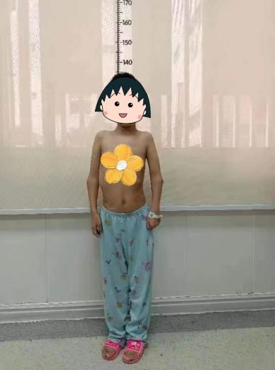 金钗女孩腰如弯弓，桂医附院脊柱外科迎难而上成功手术助其重获「挺拔人生」