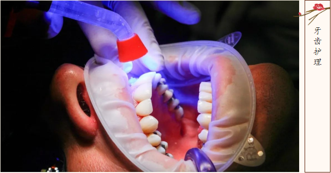 这个漂白剂还能用来根管治疗？