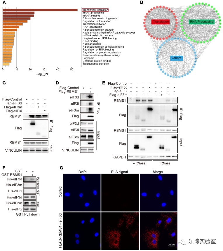 T Clin Invest. (Q1，19.546) | RBMS1通过调控SLC7A11翻译从而调节肺癌铁死亡