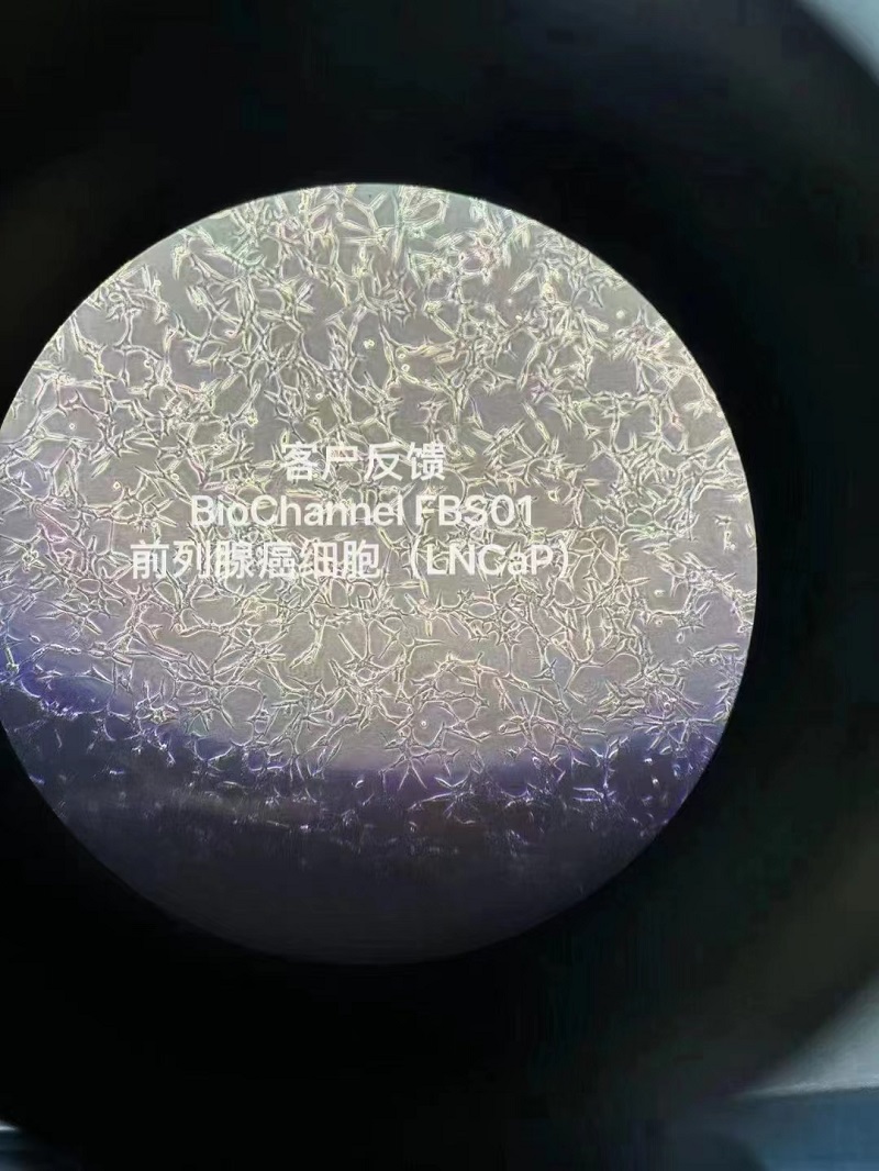 培养前列腺癌细胞（LNCaP）-客户反馈