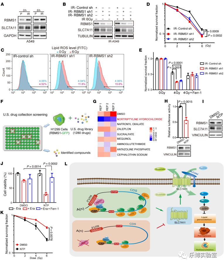 T Clin Invest. (Q1，19.546) | RBMS1通过调控SLC7A11翻译从而调节肺癌铁死亡