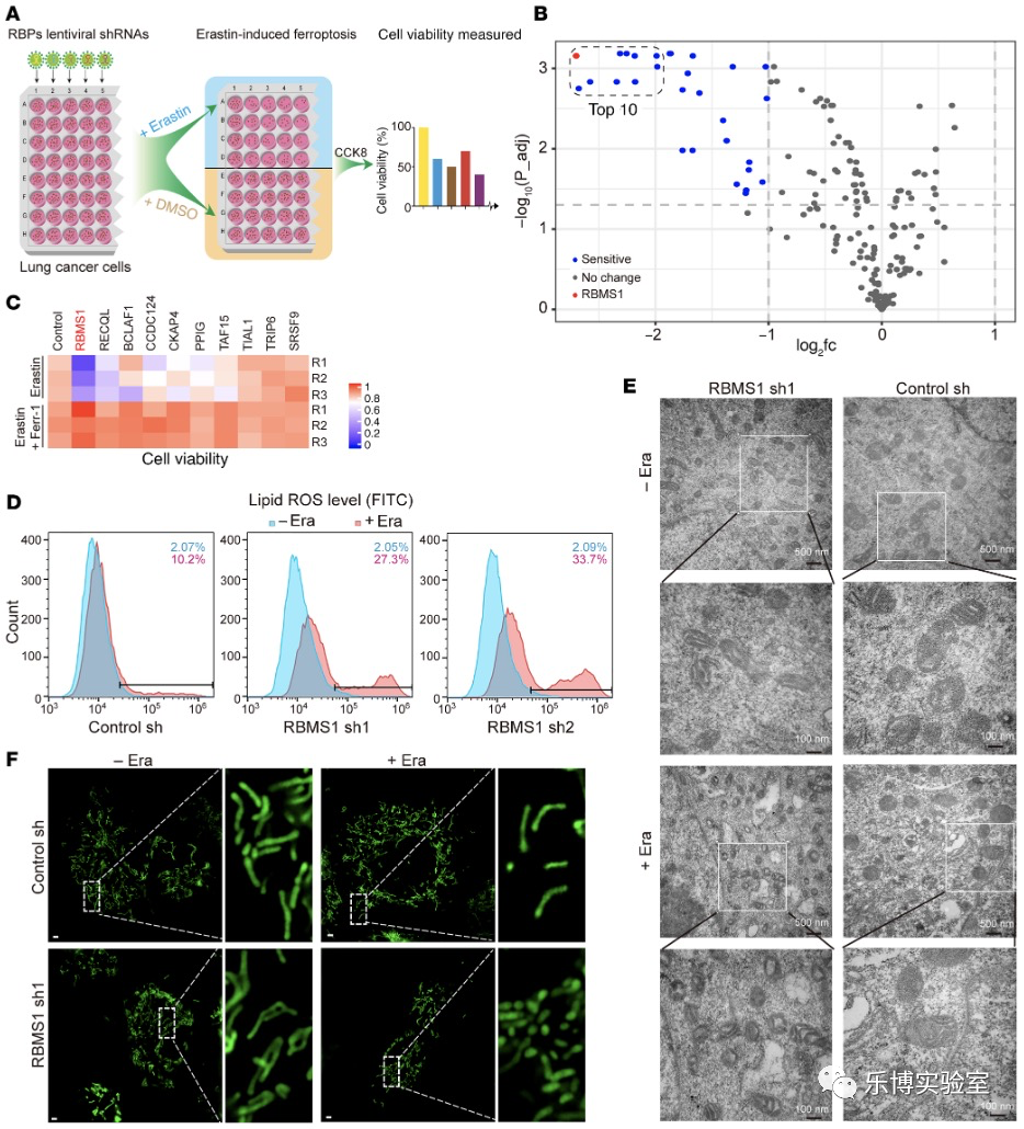 T Clin Invest. (Q1，19.546) | RBMS1通过调控SLC7A11翻译从而调节肺癌铁死亡