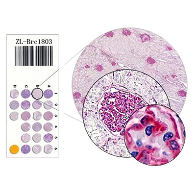三阴性乳腺癌组织芯片ZL-Brc3N961