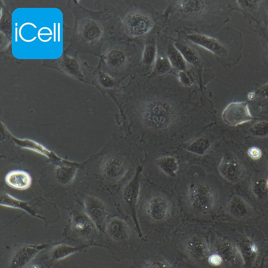 huvec细胞   人脐静脉内皮细胞 免疫荧光鉴定