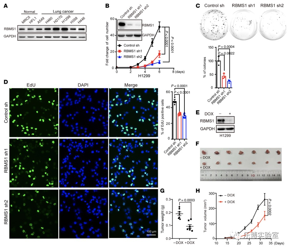T Clin Invest. (Q1，19.546) | RBMS1通过调控SLC7A11翻译从而调节肺癌铁死亡