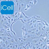 769-P 人肾细胞腺癌细胞/769-P/769-P细胞/769P/769P细胞/STR鉴定/镜像绮点（Cellverse）