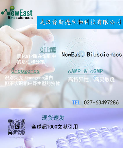 Anti RhoA GTP Mouse Monoclonal Antibody--NewEastbio