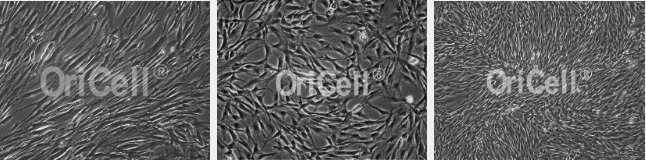 out晒头！如何正确更换细胞培养基类型？