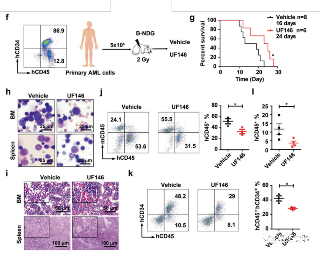 国自然热点转录调控研究之 “靶向UHRF1-SAP30-MXD4可消除髓性白血病中的白血病起始细胞”