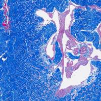 Masson染色实验代测