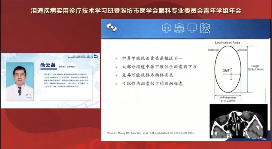 泪道疾病实用诊疗技术学习班暨潍坊市医学会眼科专业委员会青年学组年会精彩回顾