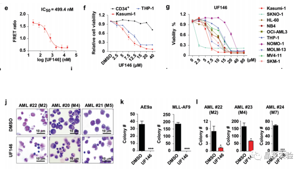 国自然热点转录调控研究之 “靶向UHRF1-SAP30-MXD4可消除髓性白血病中的白血病起始细胞”
