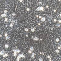 兔肺微血管内皮细胞/免疫荧光鉴定/镜像绮点（Cellverse）