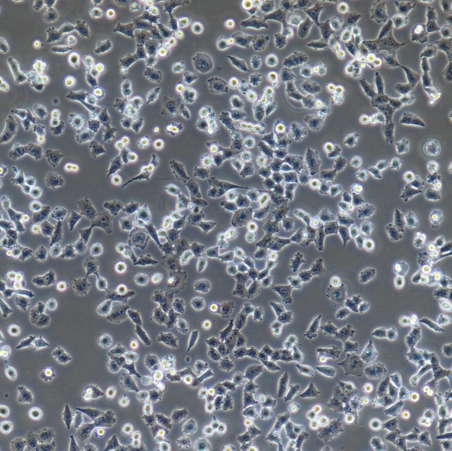 NCI-H157 人非小细胞肺腺癌细胞/STR鉴定