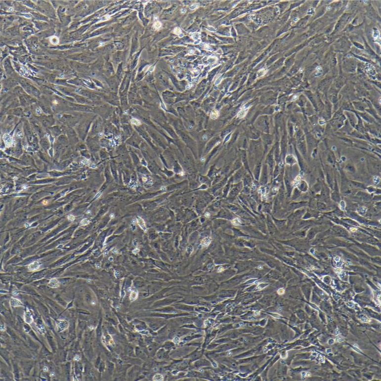 大鼠颈动脉成纤维细胞/免疫荧光鉴定/镜像绮点（Cellverse）