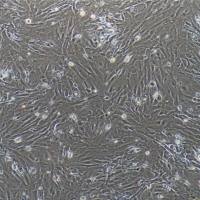 大鼠颈动脉成纤维细胞/免疫荧光鉴定