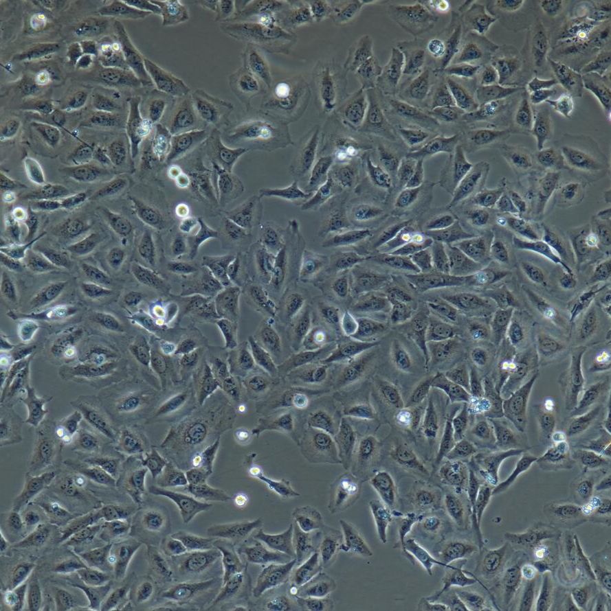 NCI-H460 人大细胞肺癌细胞/STR鉴定/镜像绮点（Cellverse）