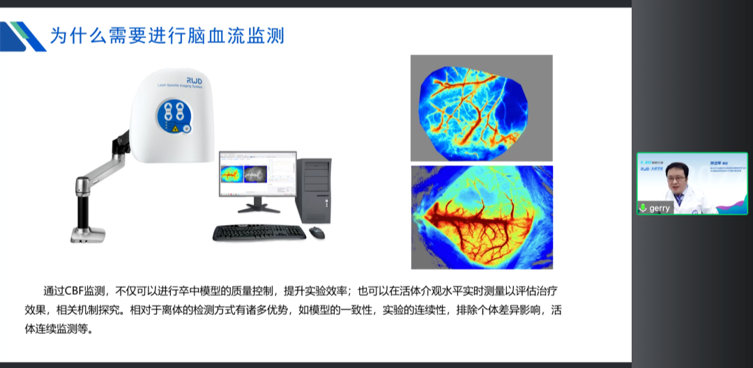 直播回顾 | 华西钟治晖教授做客「大成学堂」，分享非人灵长类脑血管疾病动物模型中的创新和应用
