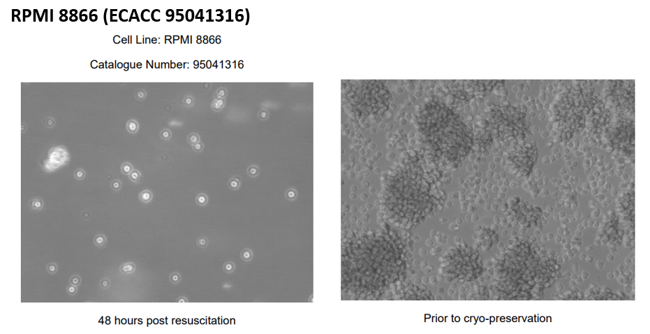 国际认证细胞库之·缘起——欧洲ECACC