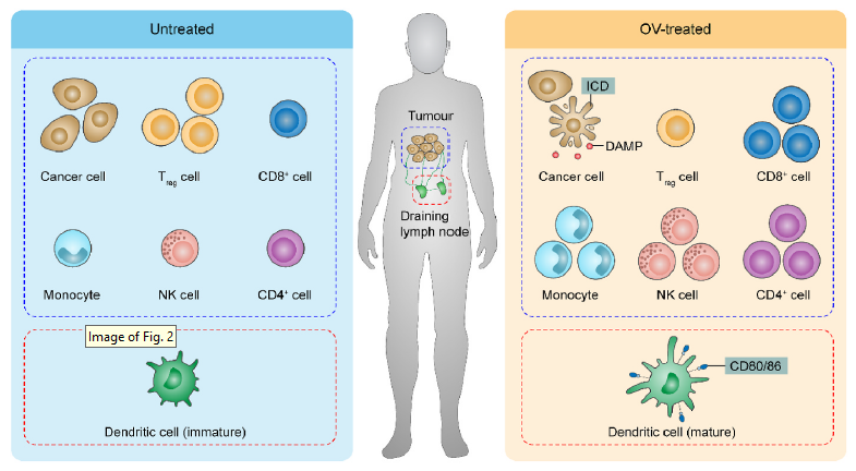 综述丨溶瘤病毒助推免疫检查点抑制：发展现状与未来的挑战