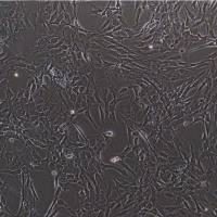 猪主动脉瓣膜间质细胞  免疫荧光鉴定