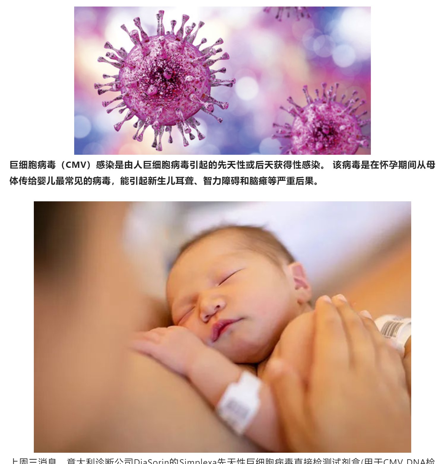 FDA批准唾液和尿液样本的CMV分子检测