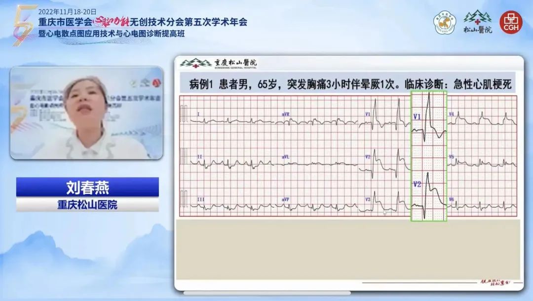 慧眼识「心电」！重庆市心脏功能无创技术分会学术年会顺利举办