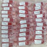 兔前列腺基底细胞/免疫荧光鉴定/镜像绮点（Cellverse）