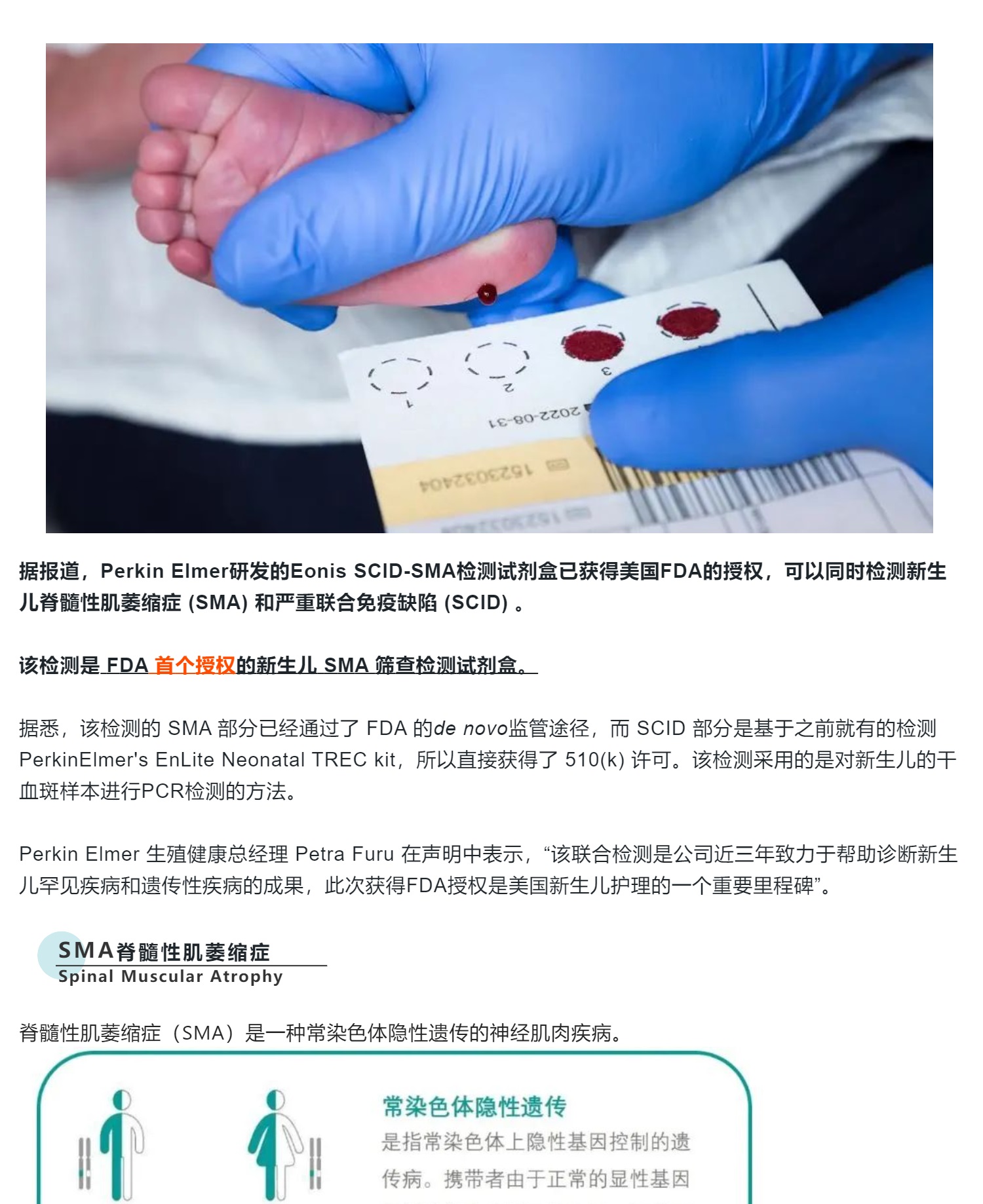 获FDA授权的新生儿SCID/SMA 联合分子检测！