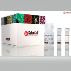 ScienCell8938人线粒体DNA拷贝数定量qPCR分析试剂盒（相对定量）RHMQ，Relative Human Mitochondrial DNA Copy Number Quantification qPCR Assay Kit产品图