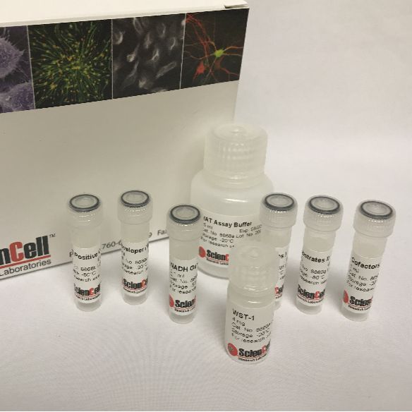 ScienCell8668比色法组蛋白乙酰转移酶活性测定，Colorimetric Histone Acetyltransferase Activity Assay