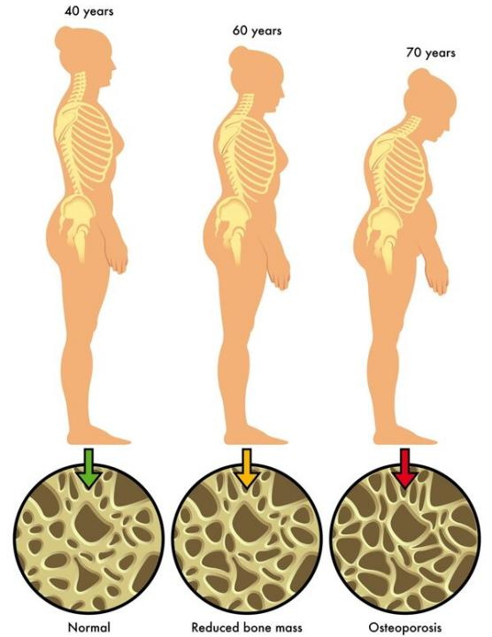 骨质疏松机制和通路研究，动物模型怎么选择？