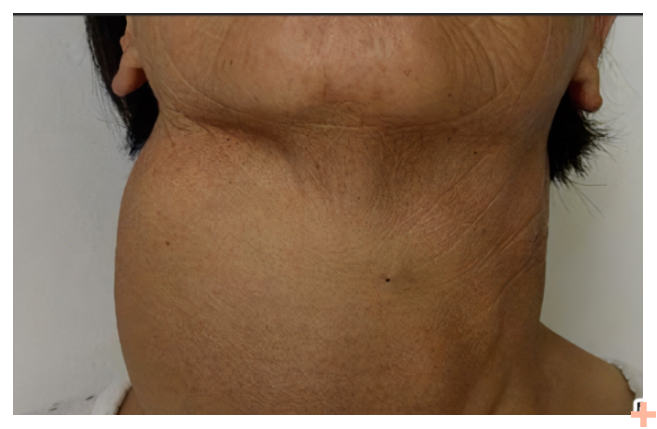 除了防治甲状腺肿，它还能做更多……