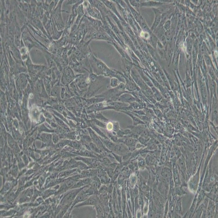 SVEC4-10细胞_小鼠淋巴结内皮细胞