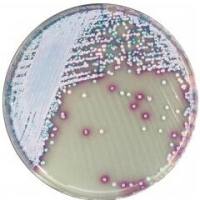 科马嘉显色培养基