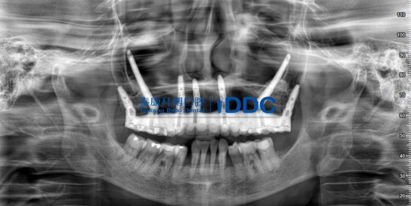 榜样医生|泰康拜博种植专家舒凌: 行医二十载,高精尖技术解决疑难病患所需