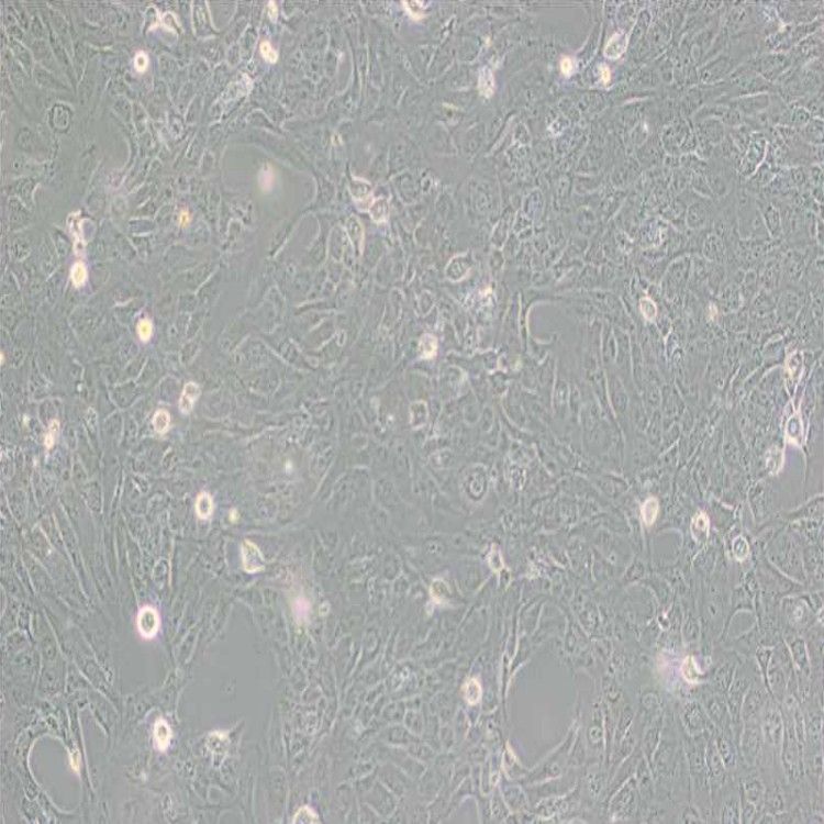 SVEC4-10细胞_小鼠淋巴结内皮细胞