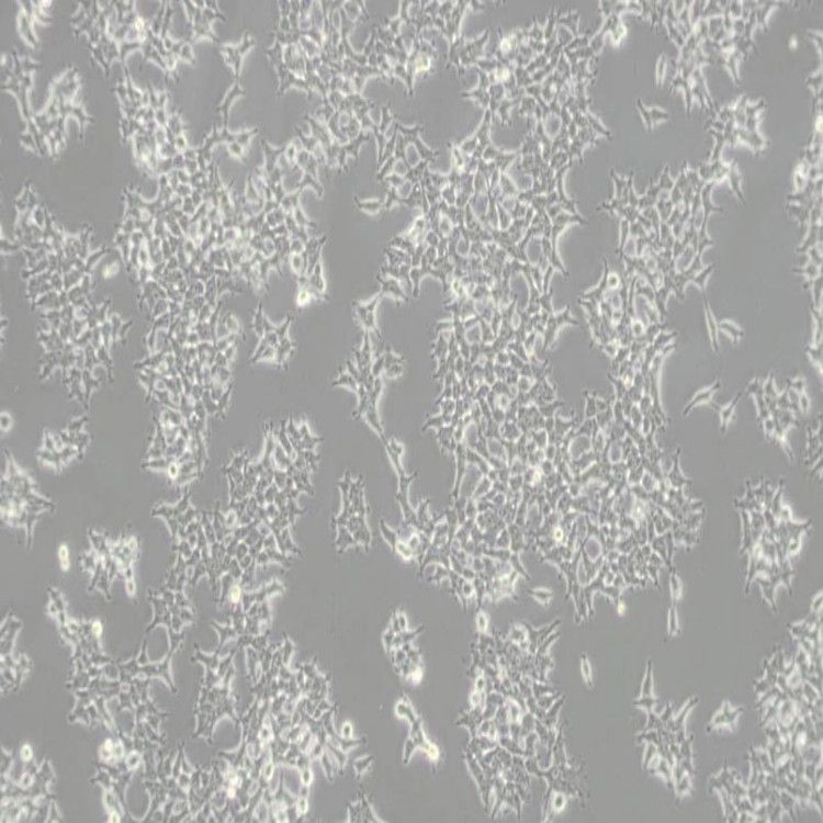 B16-F0细胞_小鼠黑色素瘤细胞