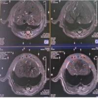 小动物核磁共振成像服务/MRI