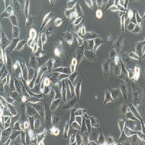 小鼠卵巢癌细胞带荧光素酶