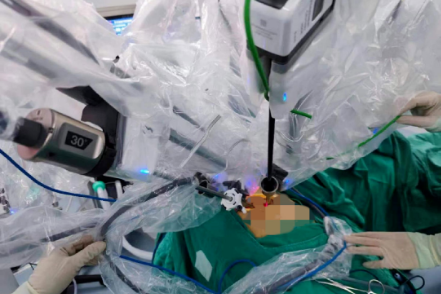 广西壮族自治区人民医院单孔达芬奇机器人手术为患者切除心包肿物