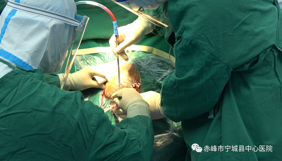 「疫」刻不停，护航生命——宁城县中心医院成功救治一名高风险区特重型颅脑损伤患者