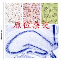 原位杂交（ISH）