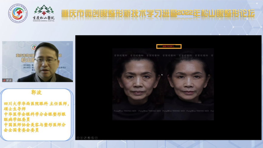院士专家汇聚，线上超 6000 人！重庆市微创眼整形新技术学习班暨松山眼整形论坛顺利召开