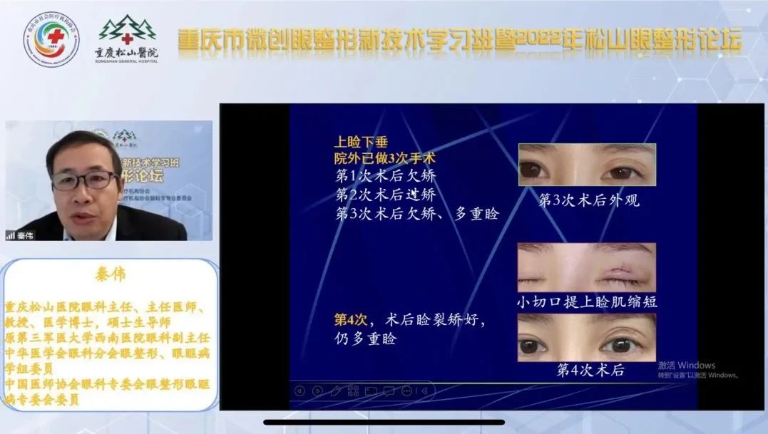 院士专家汇聚，线上超 6000 人！重庆市微创眼整形新技术学习班暨松山眼整形论坛顺利召开