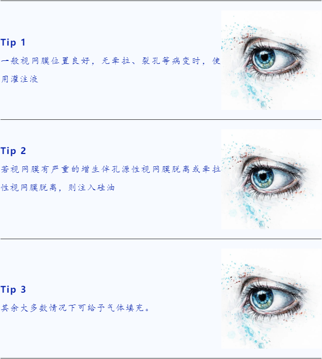 我们有四种油：甘油、石蜡油、硅油，还有爱老虎油