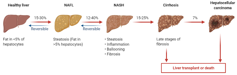 非酒精性脂肪肝炎（NASH）研究，小鼠模型怎么选择？