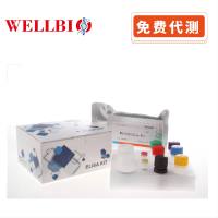 Human Perforin ELISA kit(人穿孔素 )