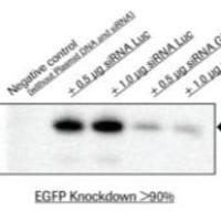 Roche 罗氏04476115001 X-tremeGENE™ siRNA 转染试剂，X