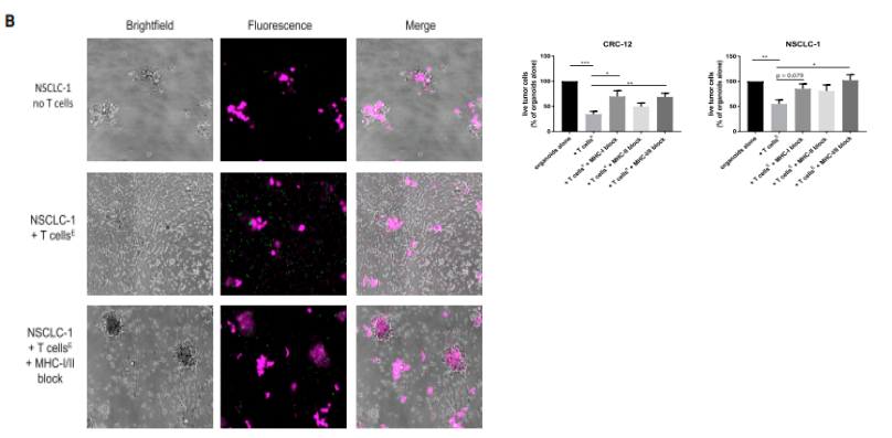 免疫共培养之——类器官